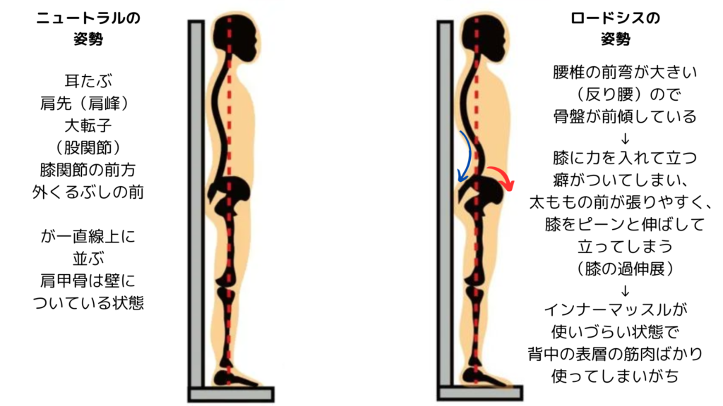 ロードシス姿勢とニュートラル姿勢との違い（パーソナルピラティス＆ヨガsmile）