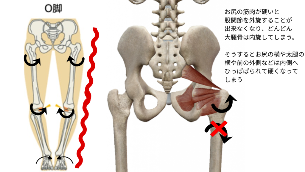 深層外旋六筋が硬くなるとどうなるか？（パーソナルピラティス＆ヨガsmile）